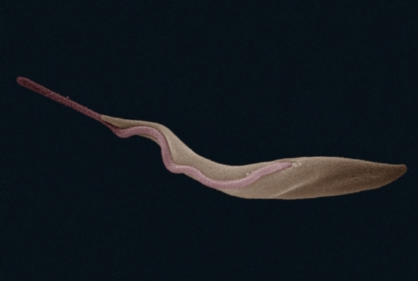 Trypanosoma brucei gambiense. Photo: Zephyris. CC BY-SA 3.0
