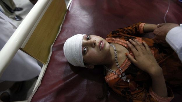 This girl was among those being treated at a hospital in Peshawar, in Pakistan