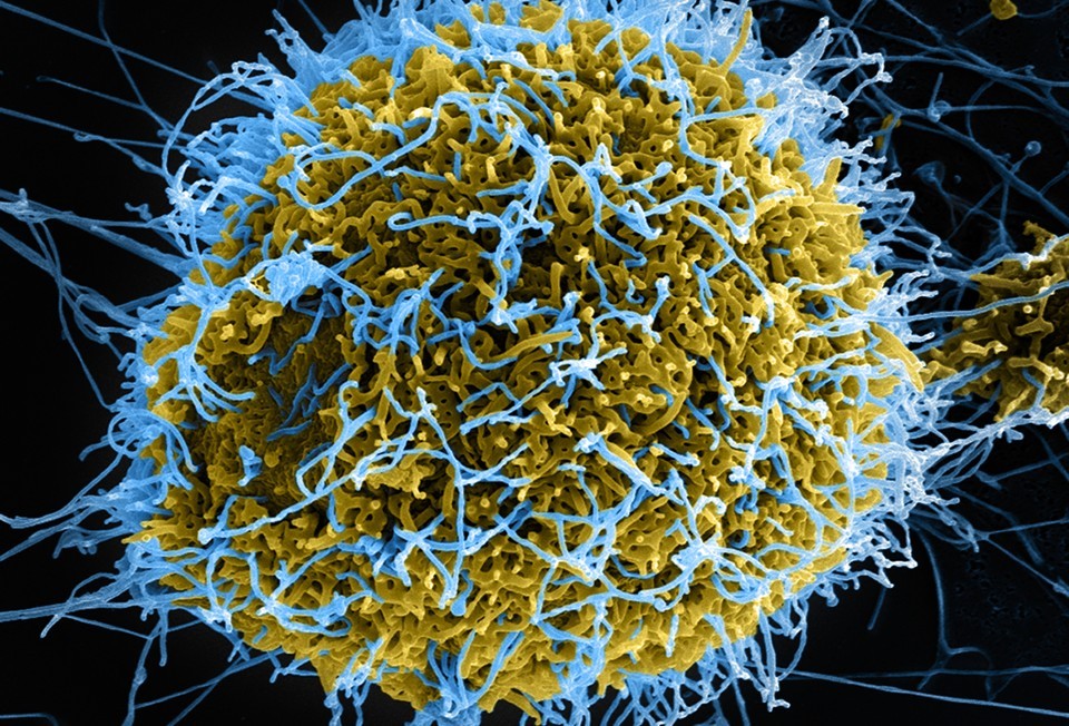 Ebola virus particles (blue) budding from an infected cell. National Institute of Allergy and Infectious Diseases, National Institutes of Health
