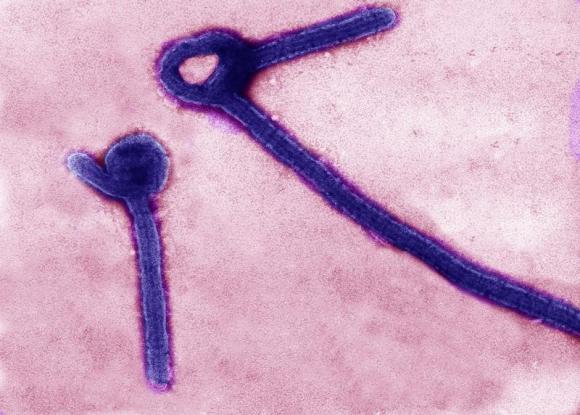 A transmission electron micrograph shows Ebola virus particles in this undated handout image released by the U.S. Army Medical Research Institute of Infectious Diseases (USAMRIID) in Fredrick, Maryland. Credit: Reuters/USAMRIID/Handout